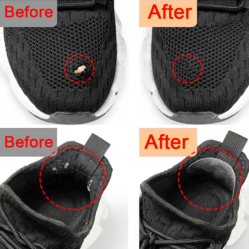 Patch per Scarpe Sportive, Rip - Sneaker Care Accessories recensione e prezzo